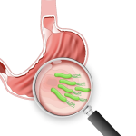 Helicobacter pylori Infection Treatment 